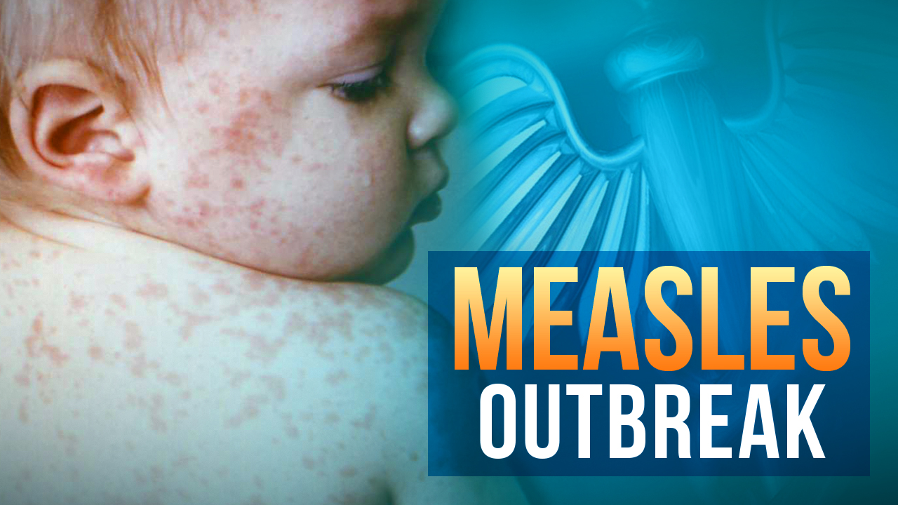 US Measles Count Surpasses 1,000