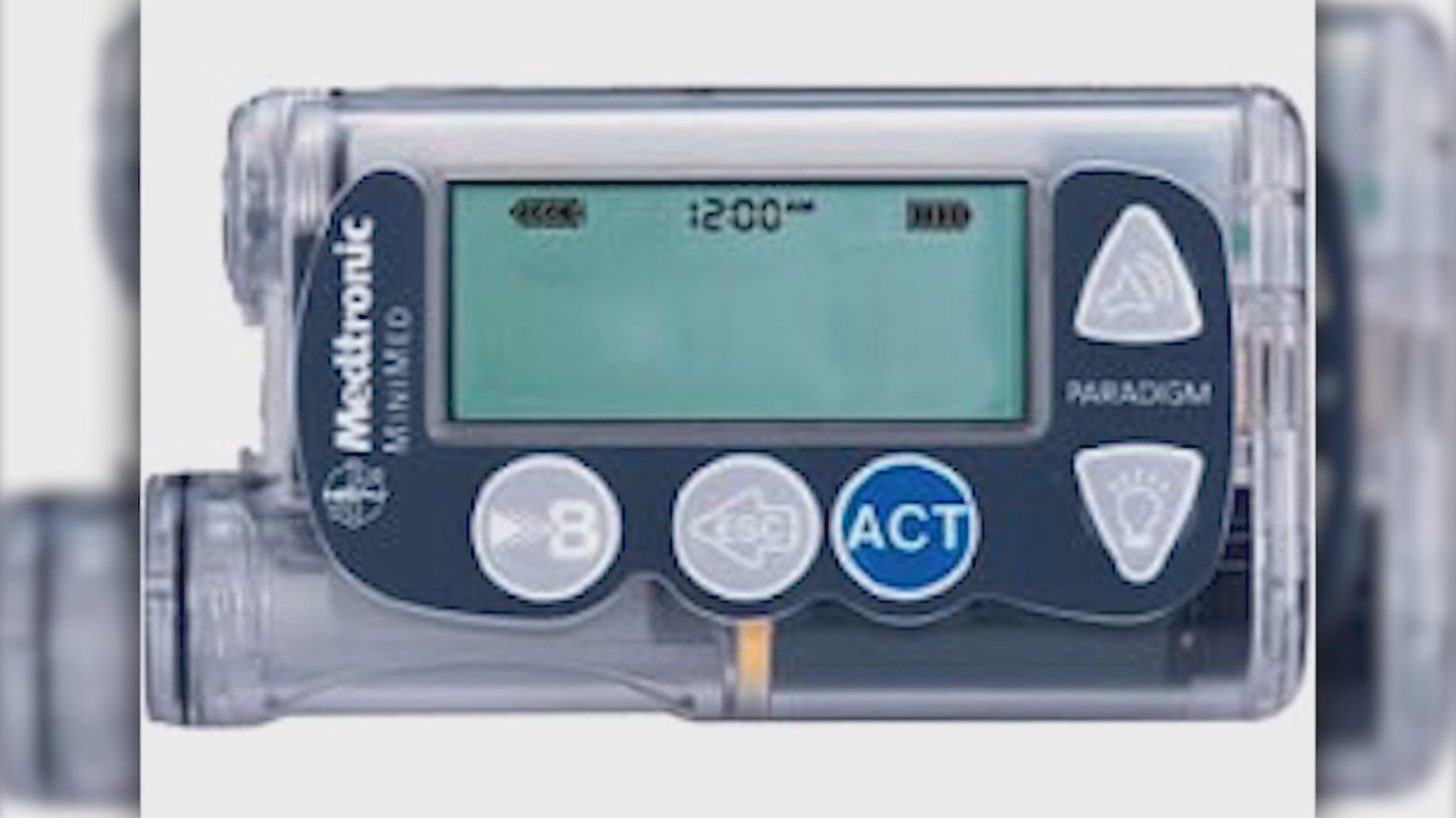 Insulin Pumps Recalled After FDA Warns Of Hacking Risk