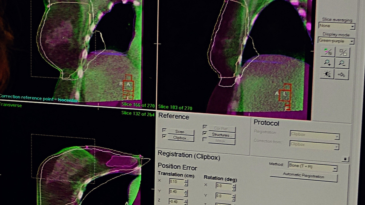 Morning People May Have Lower Risk Of Breast Cancer, New Study Says