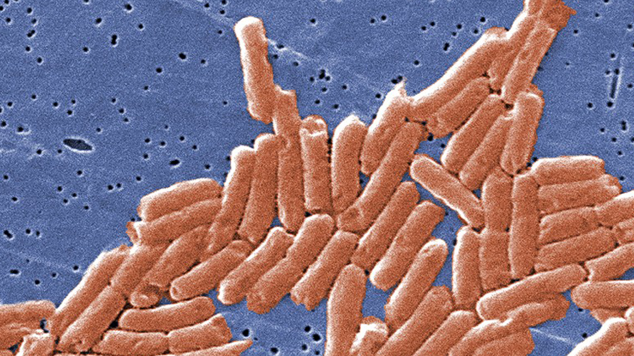 CDC Warns About Deadly Drug-Resistant Salmonella