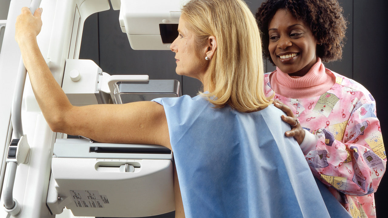 Experts Weigh in on Mammograms Starting at 40