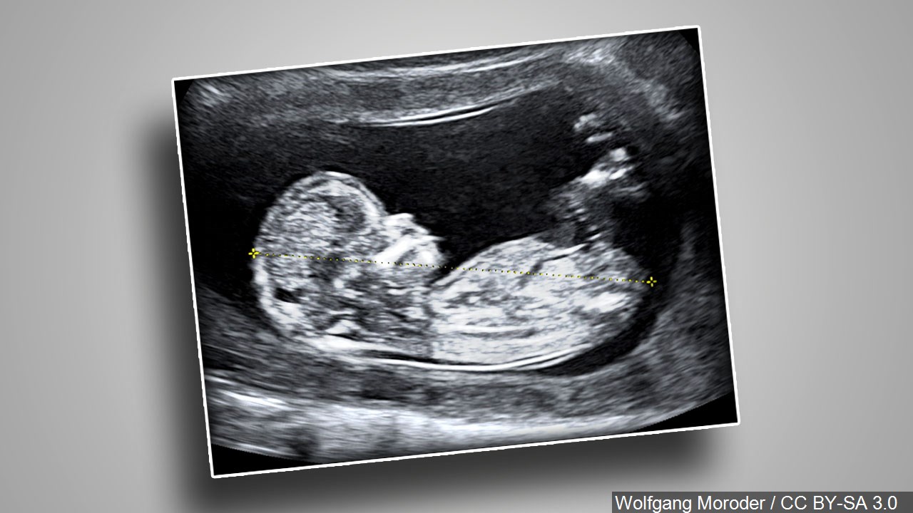 Abortion Opponents Sue NY Over Anti-Discrimination Law