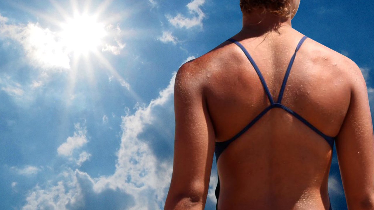 Cases Of Melanoma In Young People Declining, Study Finds
