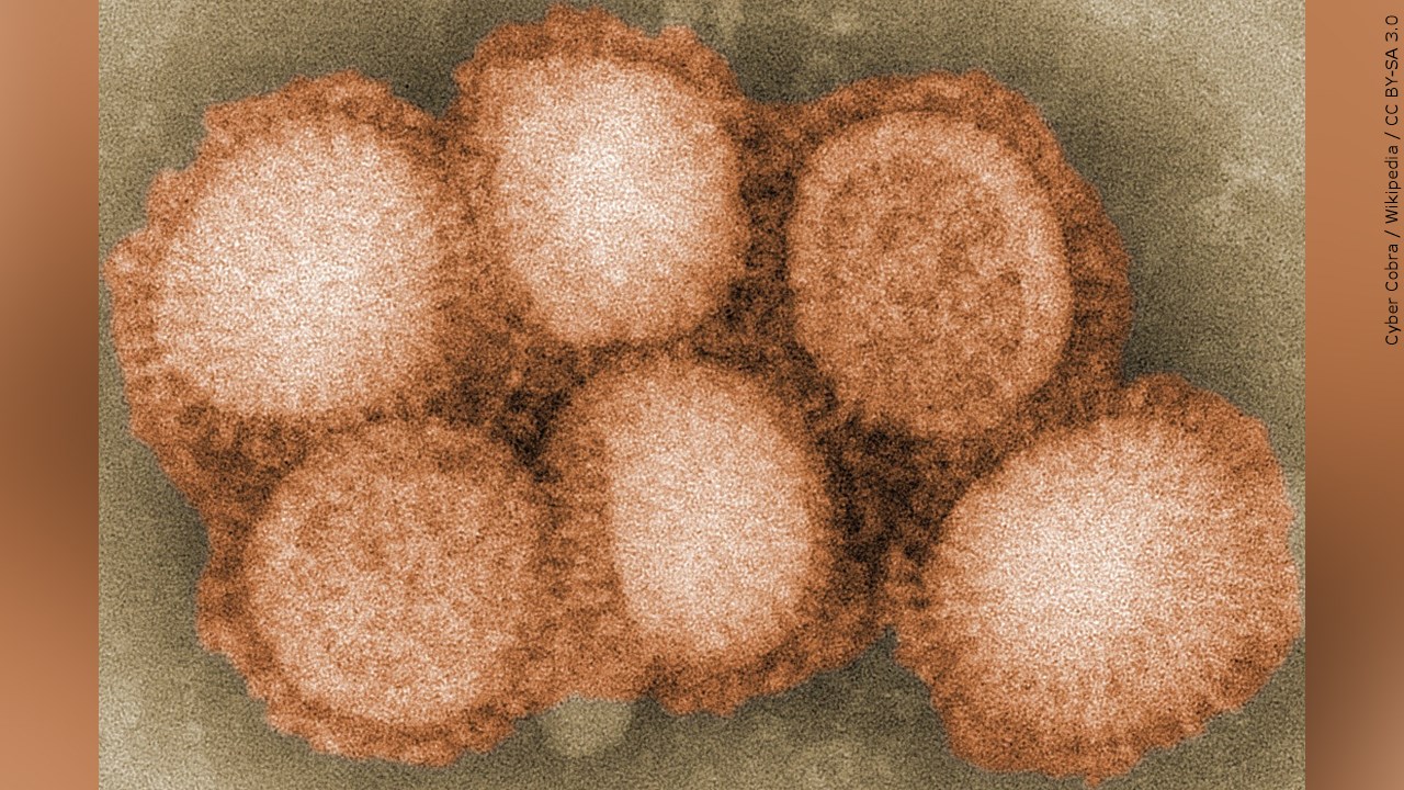 Public Asked To Report Deceased Birds In Effort To Control Flu Outbreak