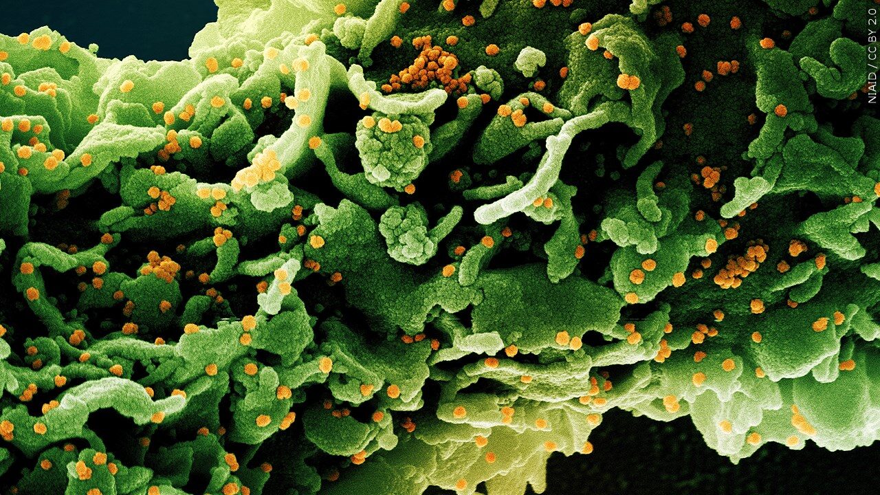 COVID variant under microscope