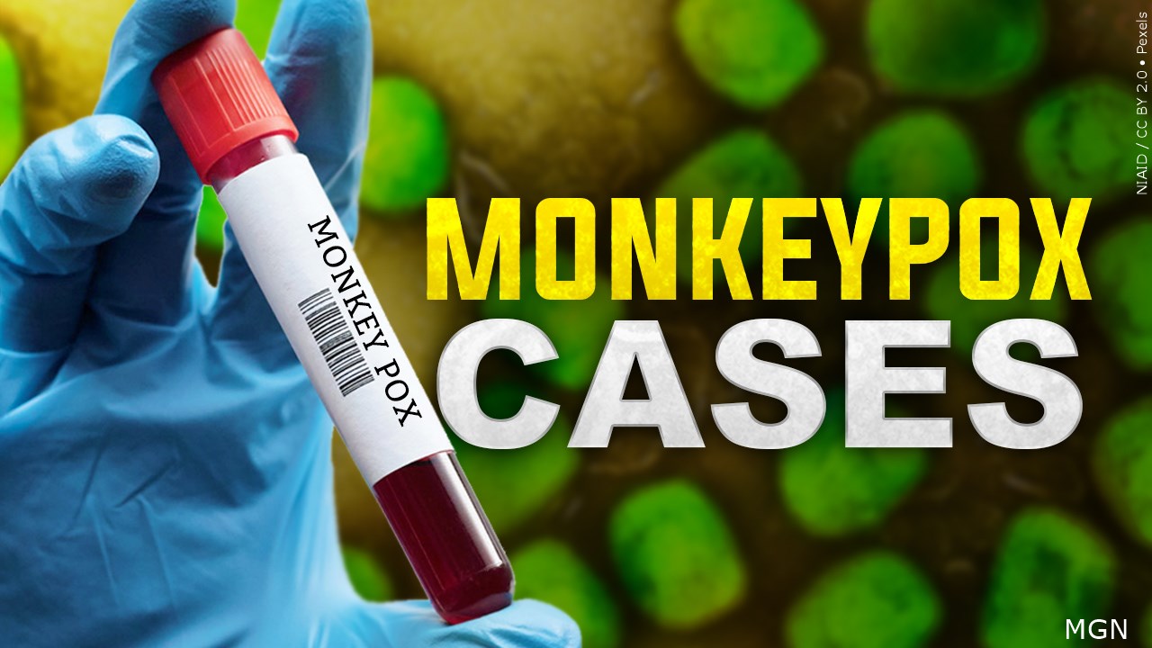 First Monkeypox Case Reported In Our Region