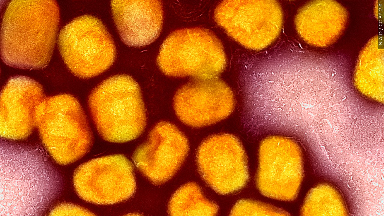 What Is Monkeypox?