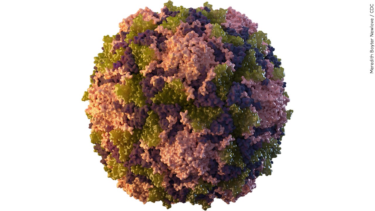 New York Reports 1st US Polio Case In Nearly A Decade 