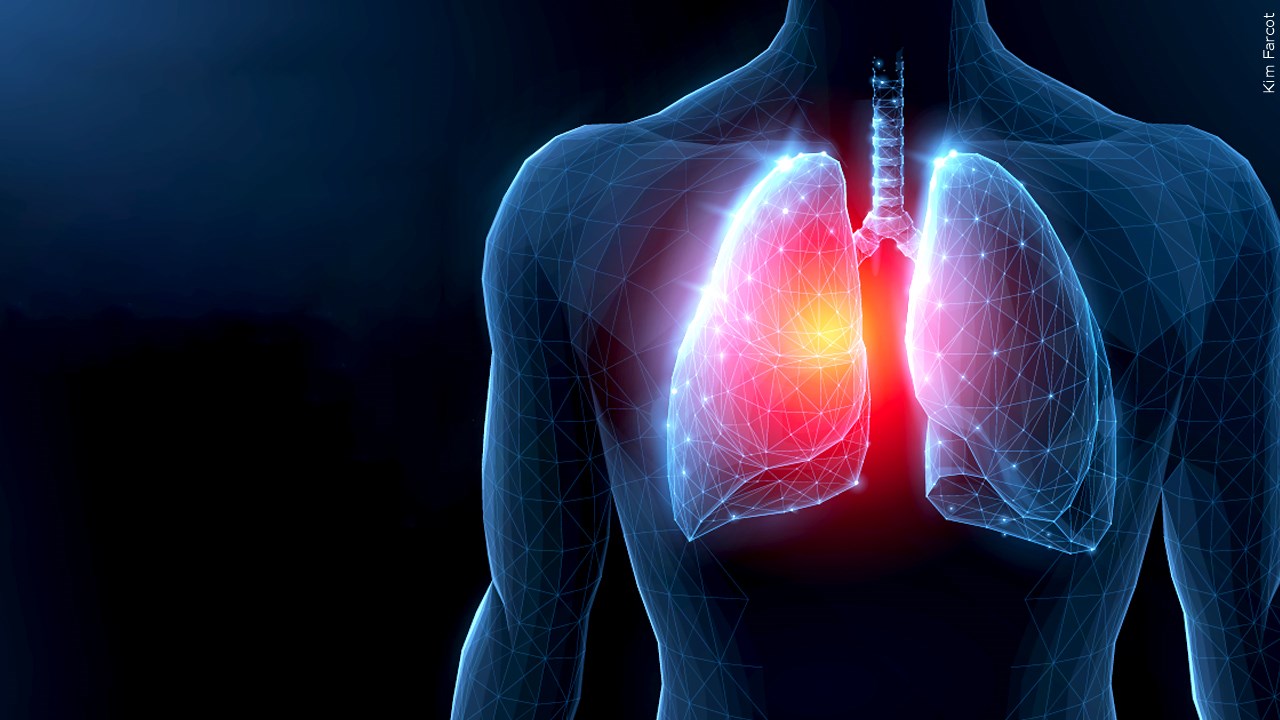 RSV weekly cases hit two year high in U.S.