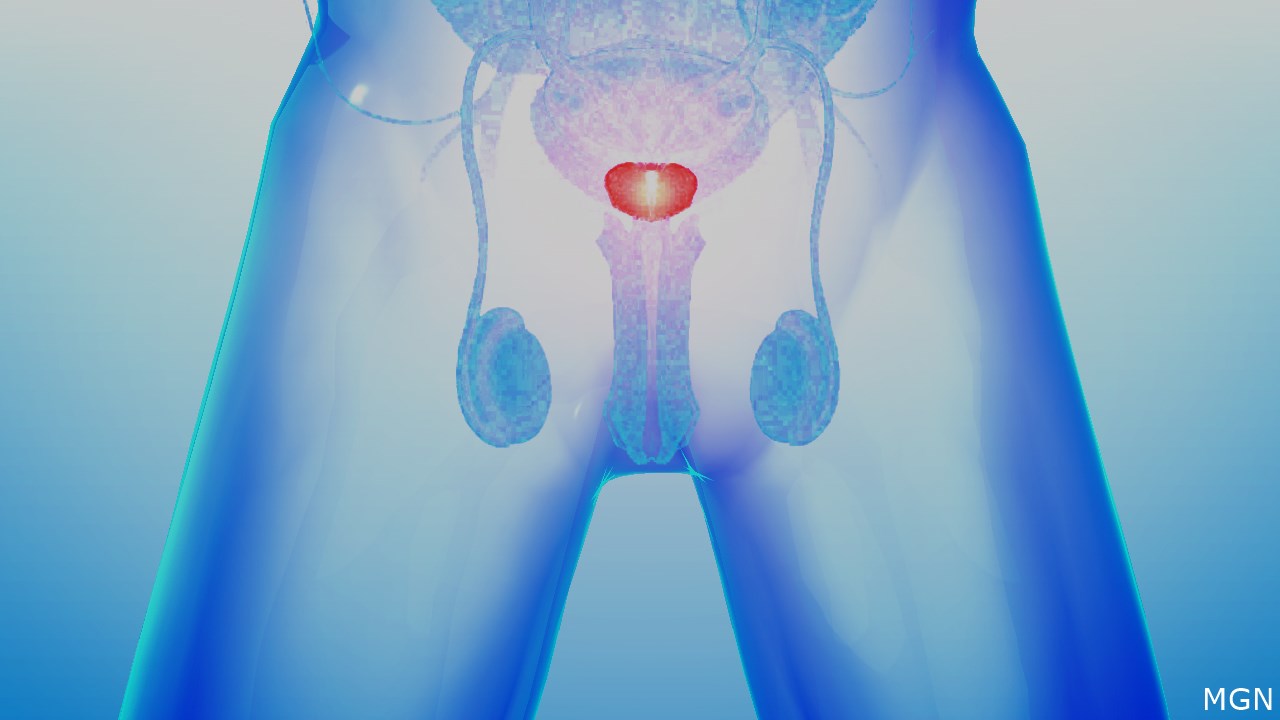 Prostate cancer treatment can wait for most men, study finds