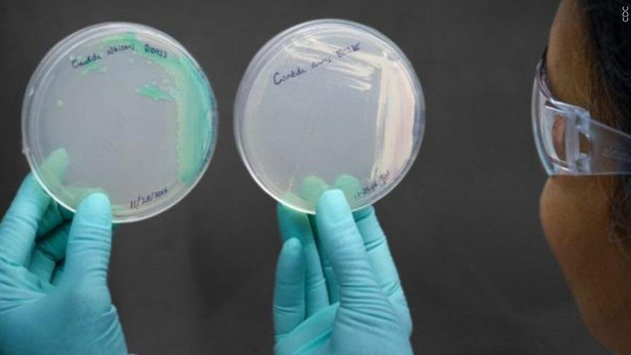 Lab worker holding up Candida auris specimens at CDC