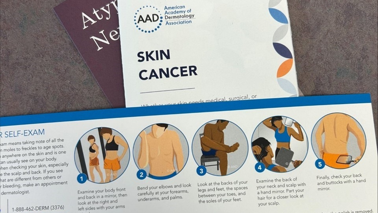 Raising Awareness about Skin Cancer